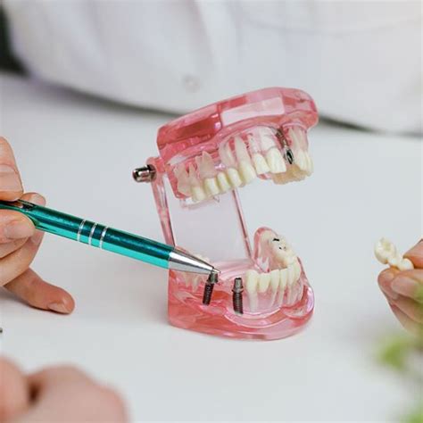 dental bridge arvada|dental implant bridge arvada.